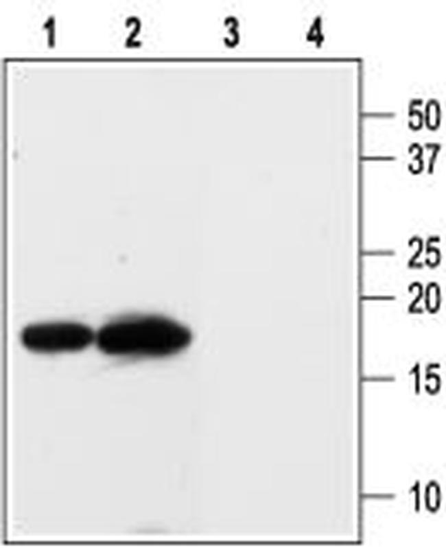 KCNE3 (MiRP2) Antibody in Western Blot (WB)