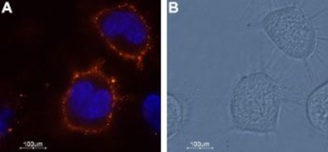 KCNK18 (TRESK) (extracellular) Antibody in Immunocytochemistry (ICC/IF)