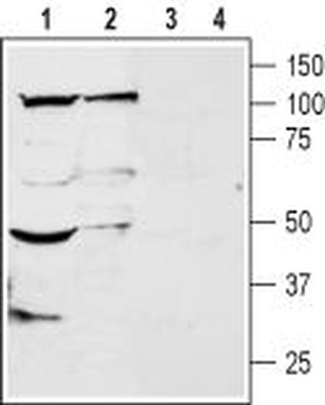 KCNK18 (TRESK) (extracellular) Antibody in Western Blot (WB)