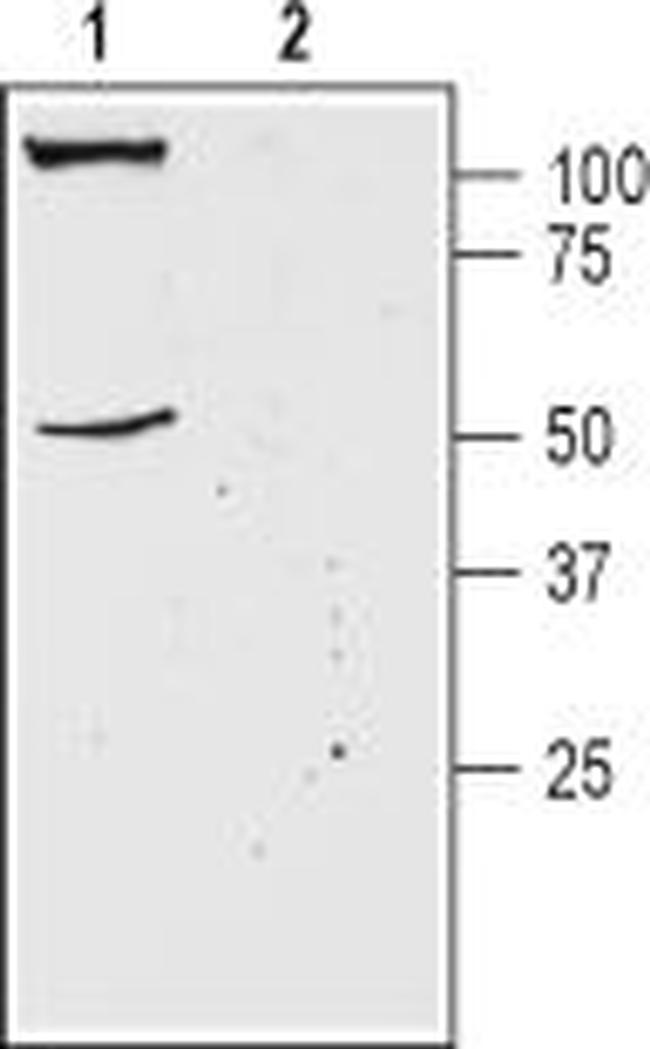 KCNK18 (TRESK) (extracellular) Antibody in Western Blot (WB)