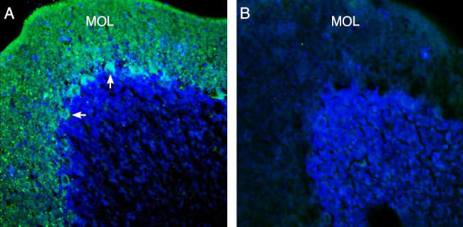 KCNT1 (Slack) Antibody in Immunohistochemistry (Frozen) (IHC (F))