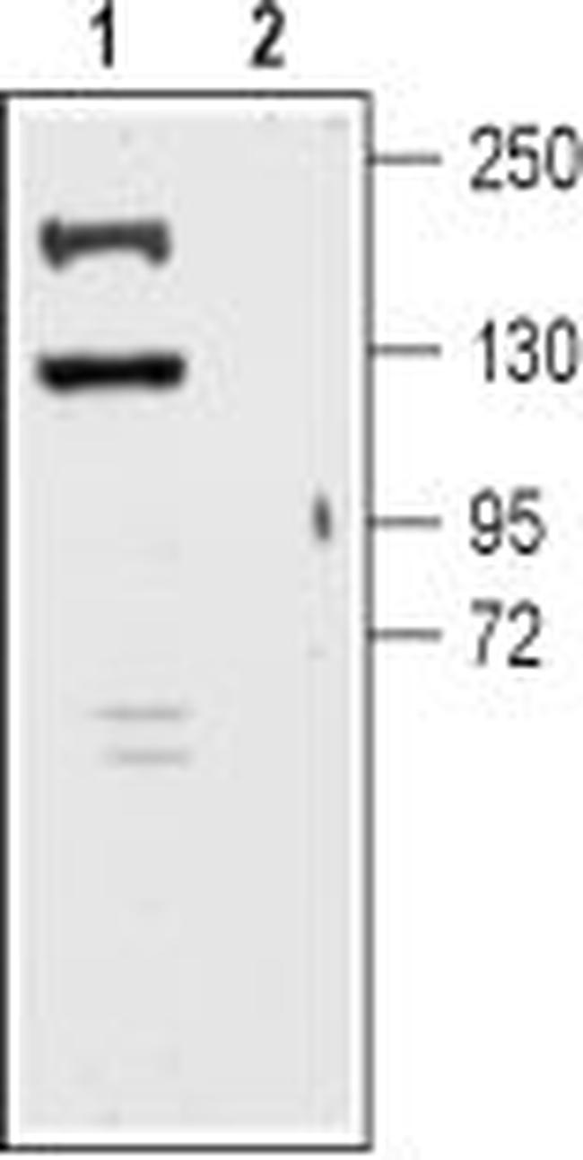 KCNT1 (Slack) Antibody in Western Blot (WB)