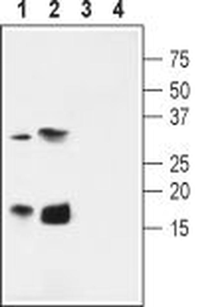 KCNE4 (MiRP3) Antibody in Western Blot (WB)