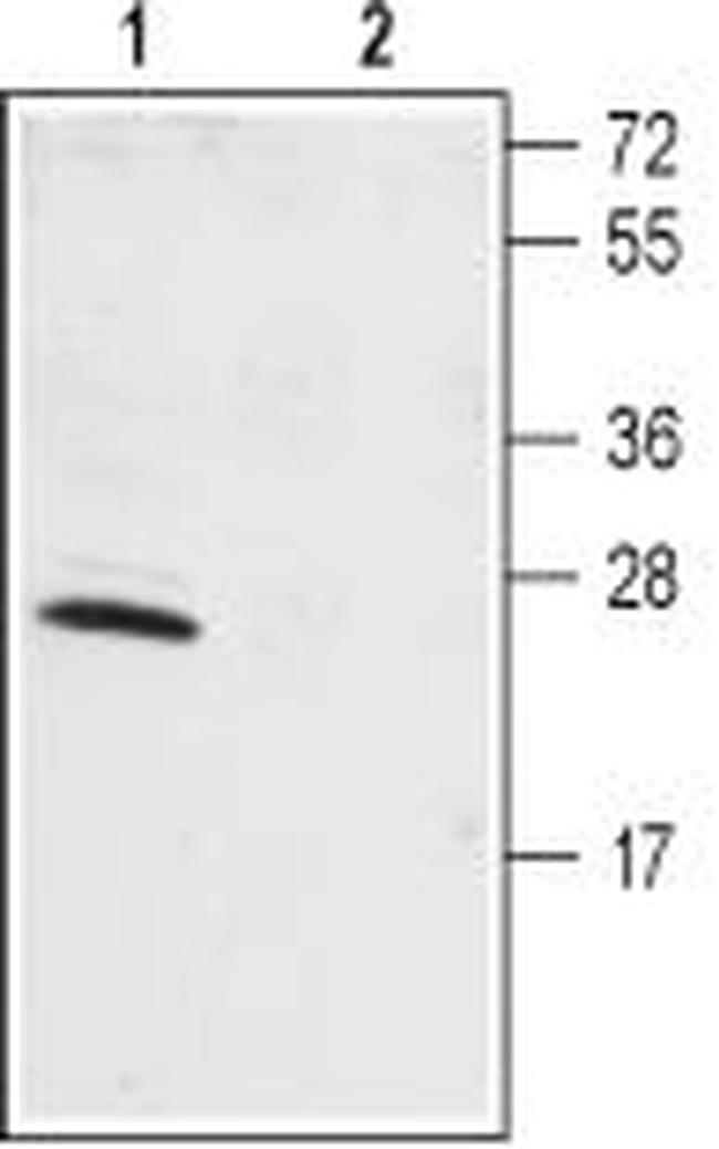 KChIP1 (KCNIP1) Antibody in Western Blot (WB)