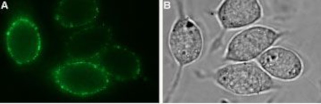 Kir2.1/KCNJ2 (extracellular) Antibody in Immunocytochemistry (ICC/IF)