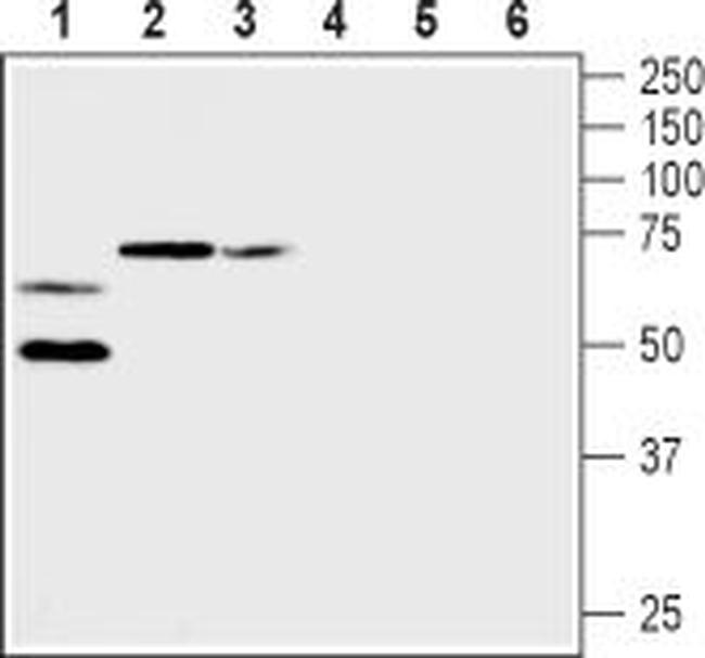 KV1.2 (KCNA2) (extracellular) Antibody in Western Blot (WB)