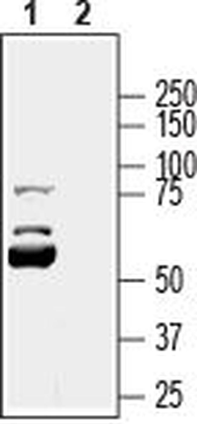 KCNK16 (TALK-1) (extracellular) Antibody in Western Blot (WB)