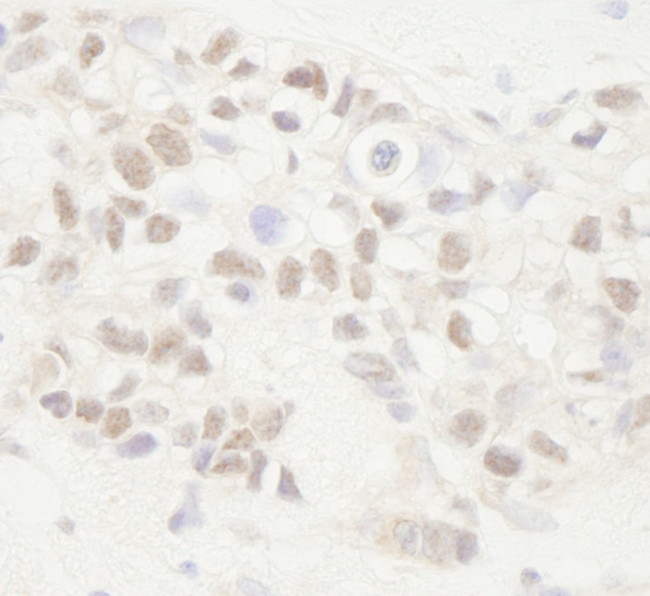 APC Antibody in Immunohistochemistry (IHC)