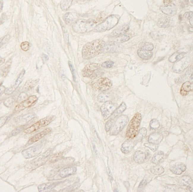 APC Antibody in Immunohistochemistry (IHC)