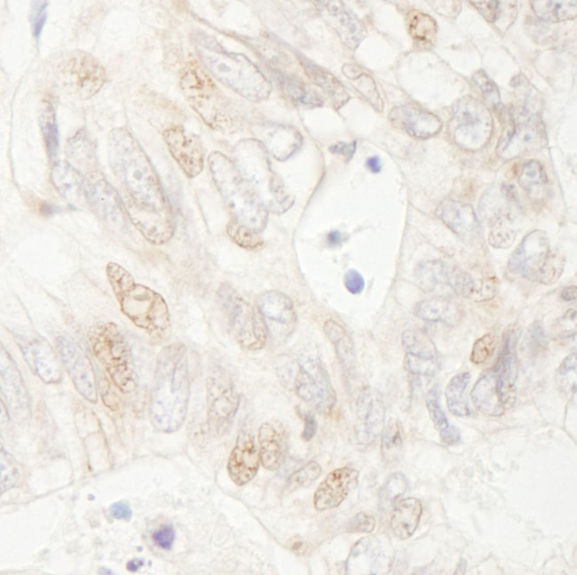 APC Antibody in Immunohistochemistry (IHC)