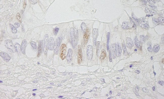 APC Antibody in Immunohistochemistry (IHC)