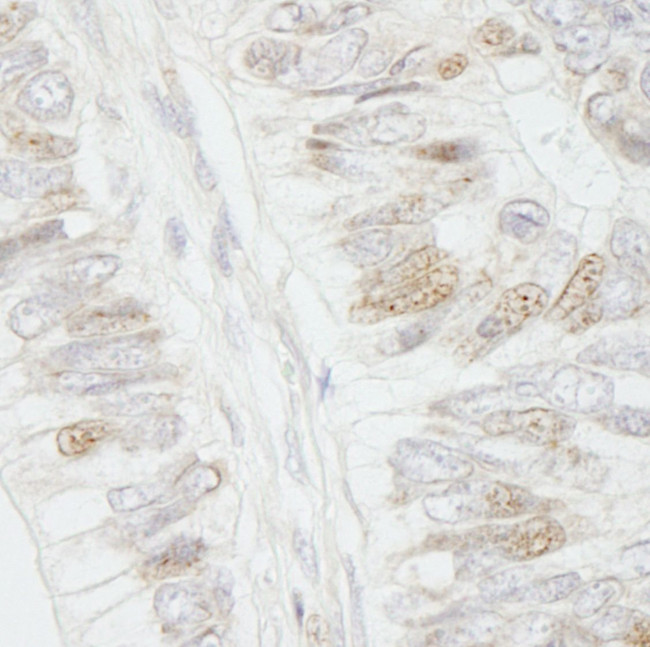 APC Antibody in Immunohistochemistry (IHC)