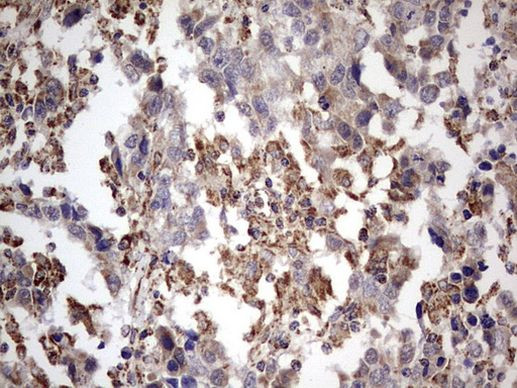 APC Antibody in Immunohistochemistry (Paraffin) (IHC (P))