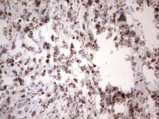 APC Antibody in Immunohistochemistry (Paraffin) (IHC (P))