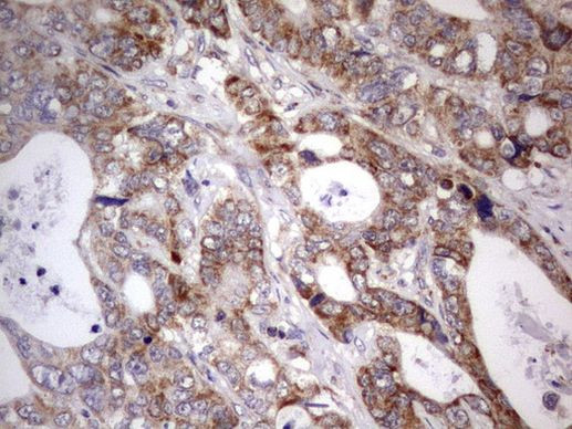 APC Antibody in Immunohistochemistry (Paraffin) (IHC (P))