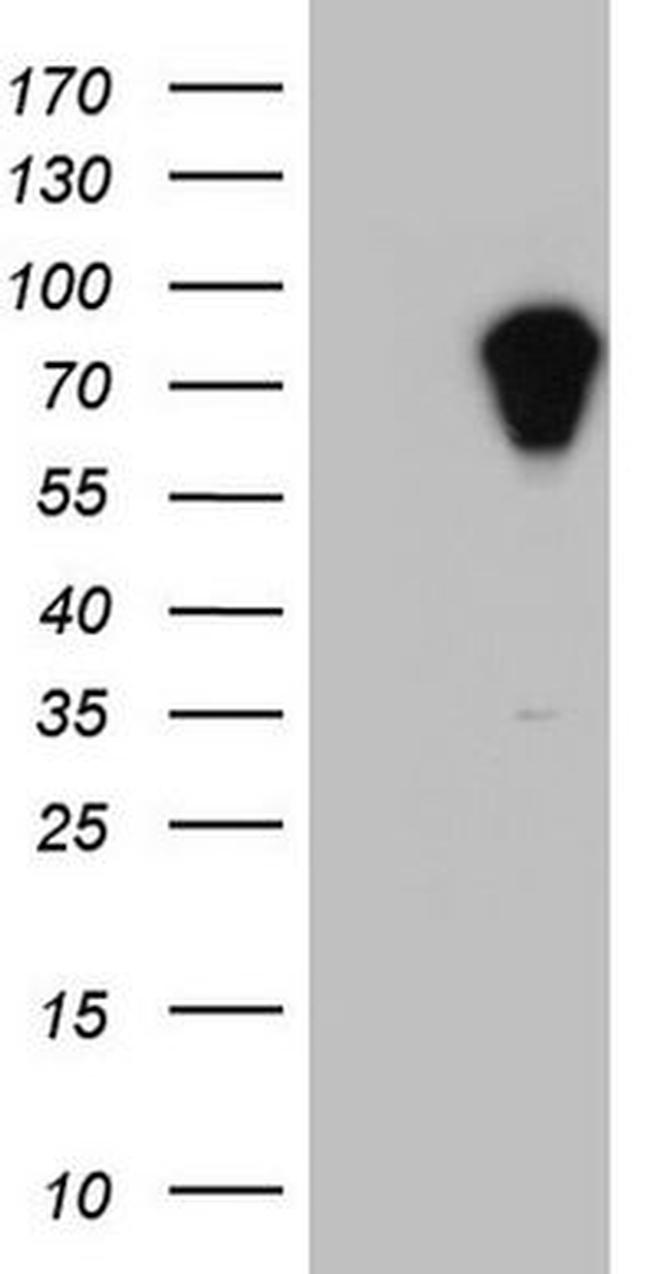 APC Antibody in Western Blot (WB)