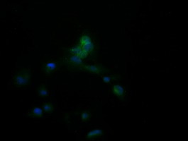 APCS Antibody in Immunocytochemistry (ICC/IF)