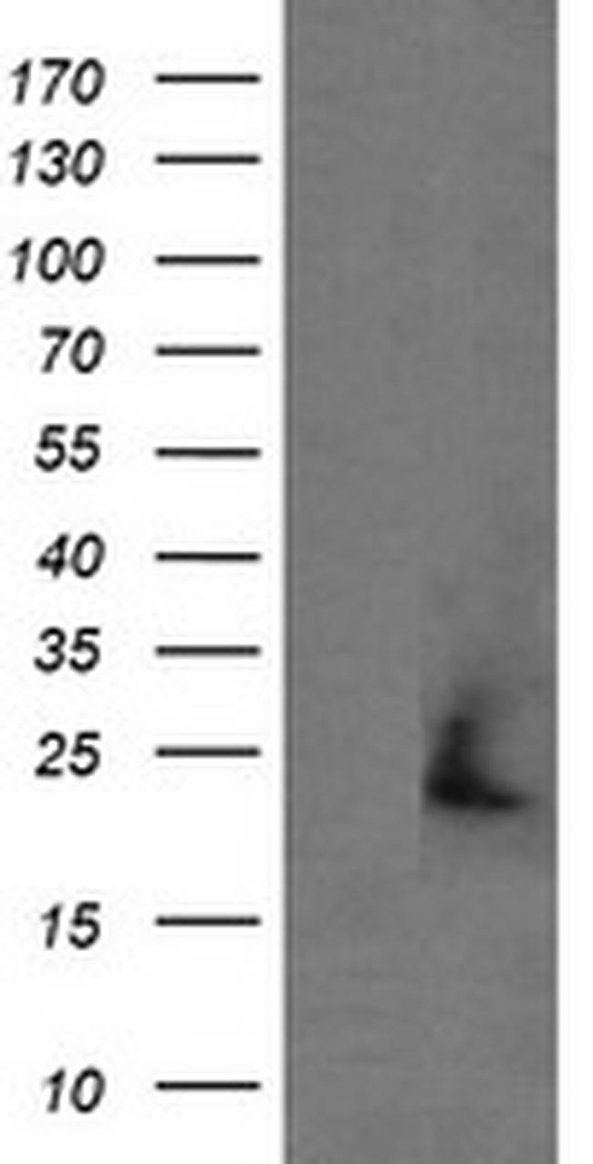 APCS Antibody in Western Blot (WB)