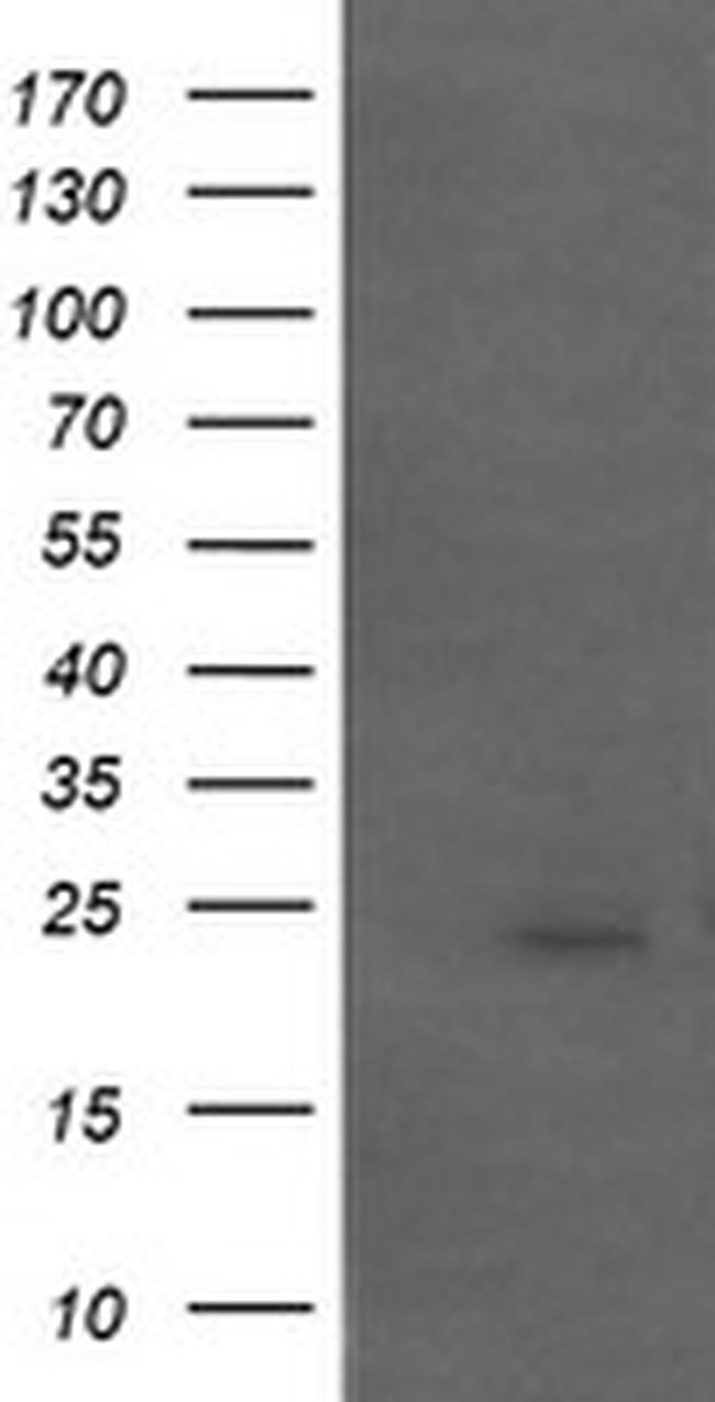 APCS Antibody in Western Blot (WB)