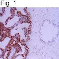 APE1 Antibody in Immunohistochemistry (IHC)