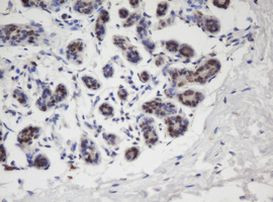 APEX1 Antibody in Immunohistochemistry (Paraffin) (IHC (P))