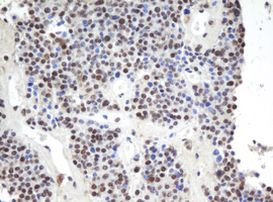 APEX1 Antibody in Immunohistochemistry (Paraffin) (IHC (P))