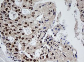 APEX1 Antibody in Immunohistochemistry (Paraffin) (IHC (P))