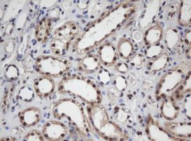 APEX1 Antibody in Immunohistochemistry (Paraffin) (IHC (P))