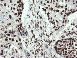 APEX1 Antibody in Immunohistochemistry (Paraffin) (IHC (P))