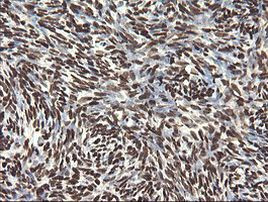 APEX1 Antibody in Immunohistochemistry (Paraffin) (IHC (P))