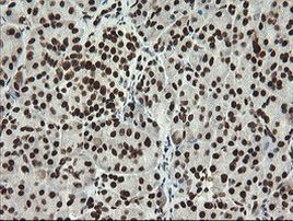 APEX1 Antibody in Immunohistochemistry (Paraffin) (IHC (P))