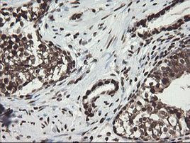 APEX1 Antibody in Immunohistochemistry (Paraffin) (IHC (P))