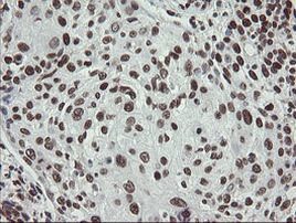 APEX1 Antibody in Immunohistochemistry (Paraffin) (IHC (P))