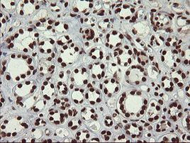 APEX1 Antibody in Immunohistochemistry (Paraffin) (IHC (P))