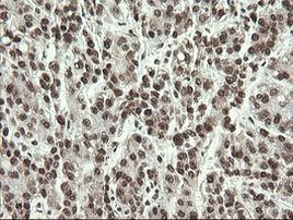 APEX1 Antibody in Immunohistochemistry (Paraffin) (IHC (P))