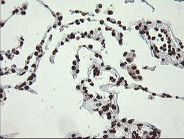 APEX1 Antibody in Immunohistochemistry (Paraffin) (IHC (P))