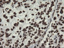 APEX1 Antibody in Immunohistochemistry (Paraffin) (IHC (P))