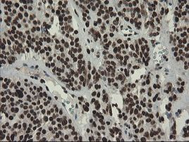 APEX1 Antibody in Immunohistochemistry (Paraffin) (IHC (P))