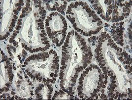 APEX1 Antibody in Immunohistochemistry (Paraffin) (IHC (P))