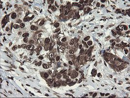 APEX1 Antibody in Immunohistochemistry (Paraffin) (IHC (P))