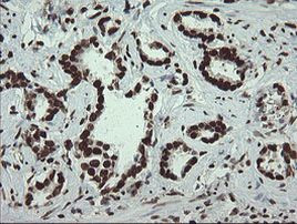 APEX1 Antibody in Immunohistochemistry (Paraffin) (IHC (P))