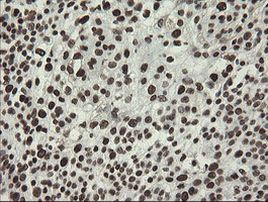 APEX1 Antibody in Immunohistochemistry (Paraffin) (IHC (P))