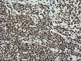 APEX1 Antibody in Immunohistochemistry (Paraffin) (IHC (P))