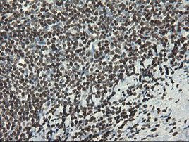 APEX1 Antibody in Immunohistochemistry (Paraffin) (IHC (P))