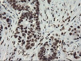 APEX1 Antibody in Immunohistochemistry (Paraffin) (IHC (P))