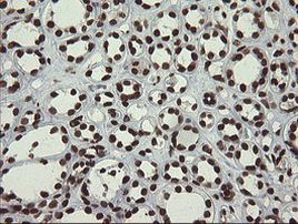 APEX1 Antibody in Immunohistochemistry (Paraffin) (IHC (P))