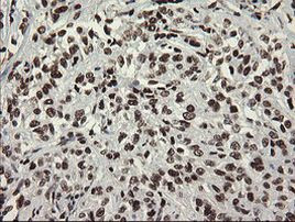 APEX1 Antibody in Immunohistochemistry (Paraffin) (IHC (P))