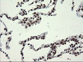 APEX1 Antibody in Immunohistochemistry (Paraffin) (IHC (P))