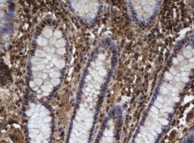 APEX1 Antibody in Immunohistochemistry (Paraffin) (IHC (P))