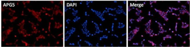 ATG5 Antibody in Immunocytochemistry (ICC/IF)